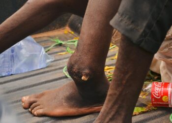 Banditry : Two Suspects With Gunshot Wounds  Arrested Inside Kogi Forest