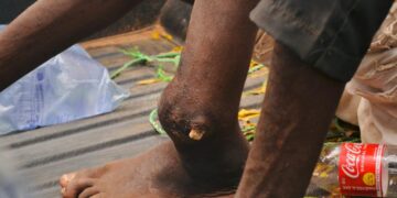 Banditry : Two Suspects With Gunshot Wounds  Arrested Inside Kogi Forest