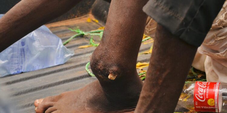 Banditry : Two Suspects With Gunshot Wounds Arrested Inside Kogi Forest