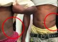 Worry Over Rising Cases Of Kidney Sales To Buy Motorcycles Among Youths In Kogi Community, Traditional Ruler Raises Alarm