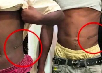 Worry Over Rising Cases Of Kidney Sales To Buy Motorcycles Among Youths In Kogi Community, Traditional Ruler Raises Alarm