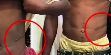 Worry Over Rising Cases Of Kidney Sales To Buy Motorcycles Among Youths In Kogi Community, Traditional Ruler Raises Alarm