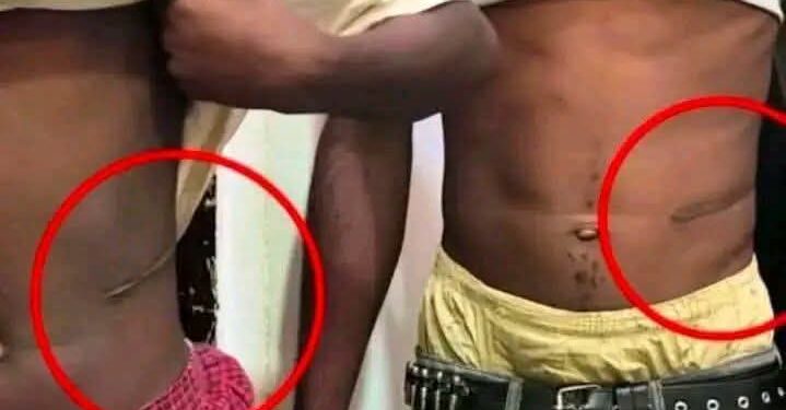 Worry Over Rising Cases Of Kidney Sales To Buy Motorcycles Among Youths In Kogi Community, Traditional Ruler Raises Alarm