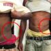 Worry Over Rising Cases Of Kidney Sales To Buy Motorcycles Among Youths In Kogi Community, Traditional Ruler Raises Alarm