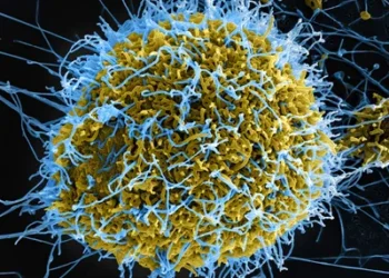 Nigeria Confirms A Case Of Import Ebola, Identifies 44 Close Contacts To Prevent Spread